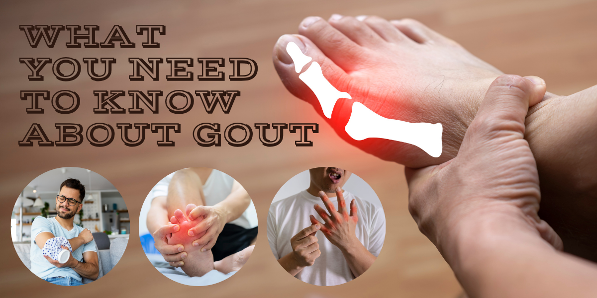 What You Need To Know About Gout