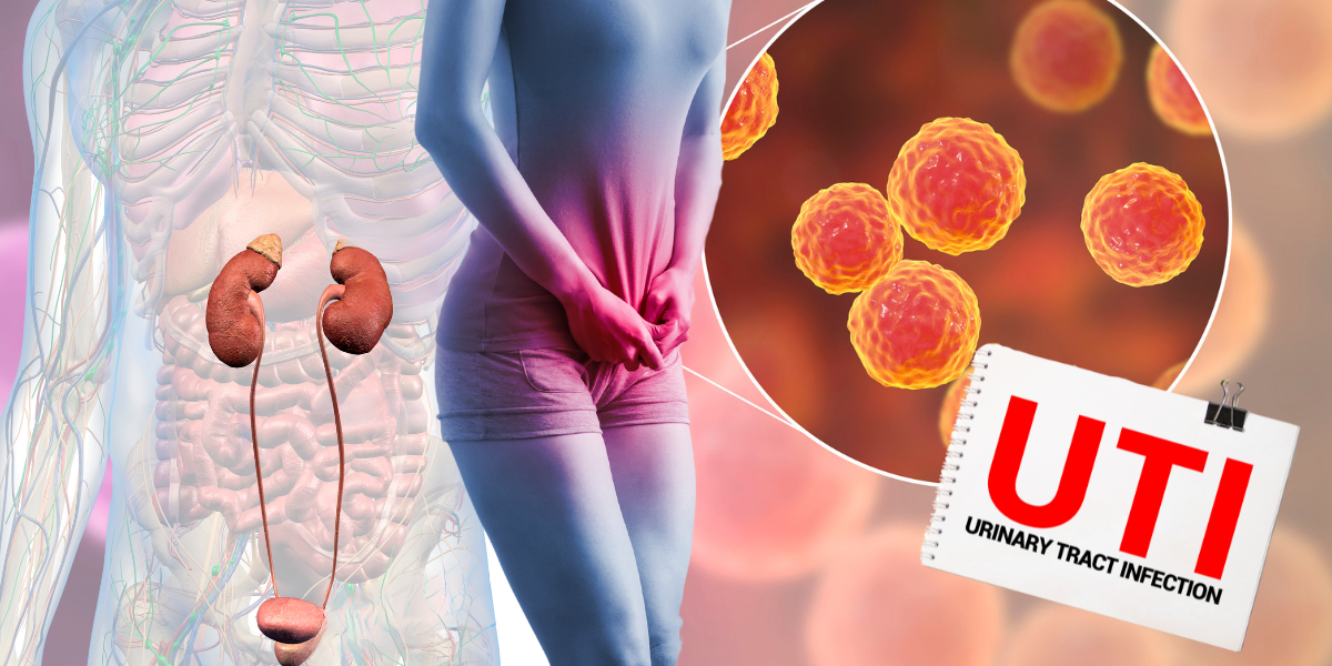 UTI! Things You Need To Know To Prevent Recurrence