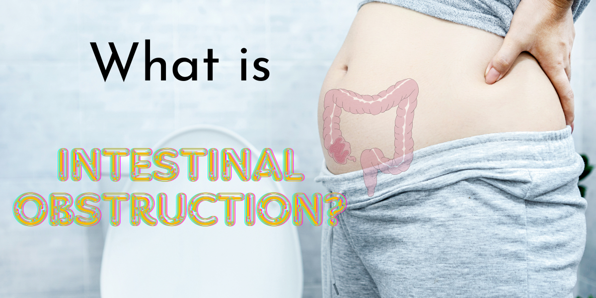 What is Intestinal Obstruction? Ultimate Guide to Deal with Bowel Obstruction!