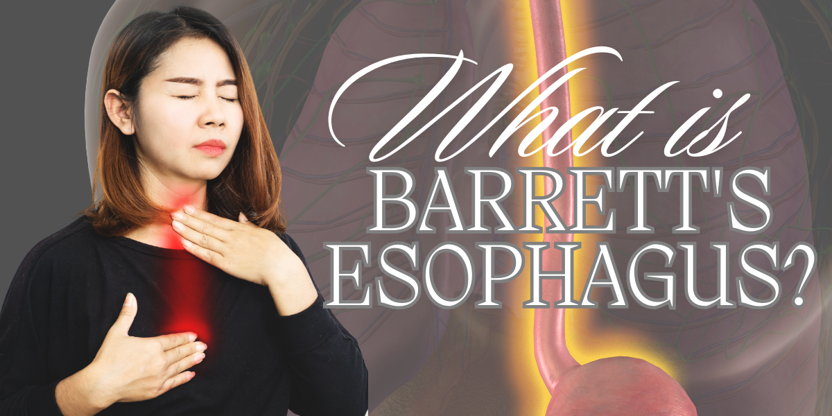 What is Barrett's Esophagus?