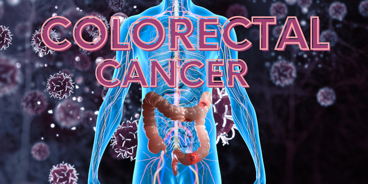 Silent Enemy: Colorectal Cancer Unveiled