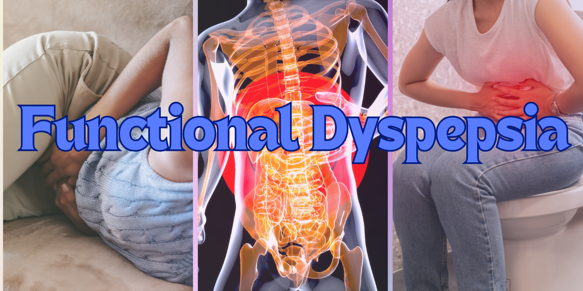 Functional Dyspepsia: How to Deal with Upset Stomach?