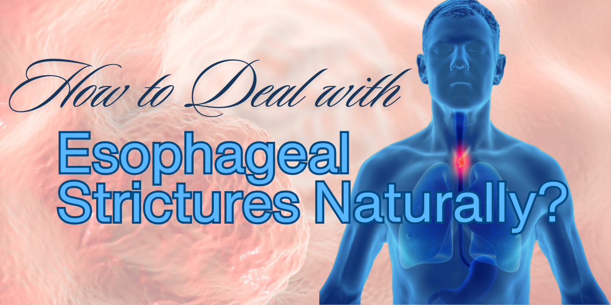 How to Deal with Esophageal Strictures Naturally?