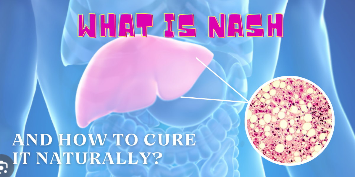 What is NASH and How to Cure it Naturally?